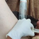 Time lapse penis pump