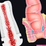 Anal Channel Male Masturbator