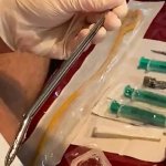 Hairy Insemination Porn Videos