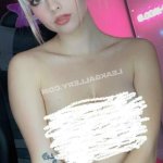 Burchtwins Exclusive Leaked Nude Onlyfans 10204083