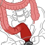 An In-Depth Guide to Anal Training Stretching Gaping