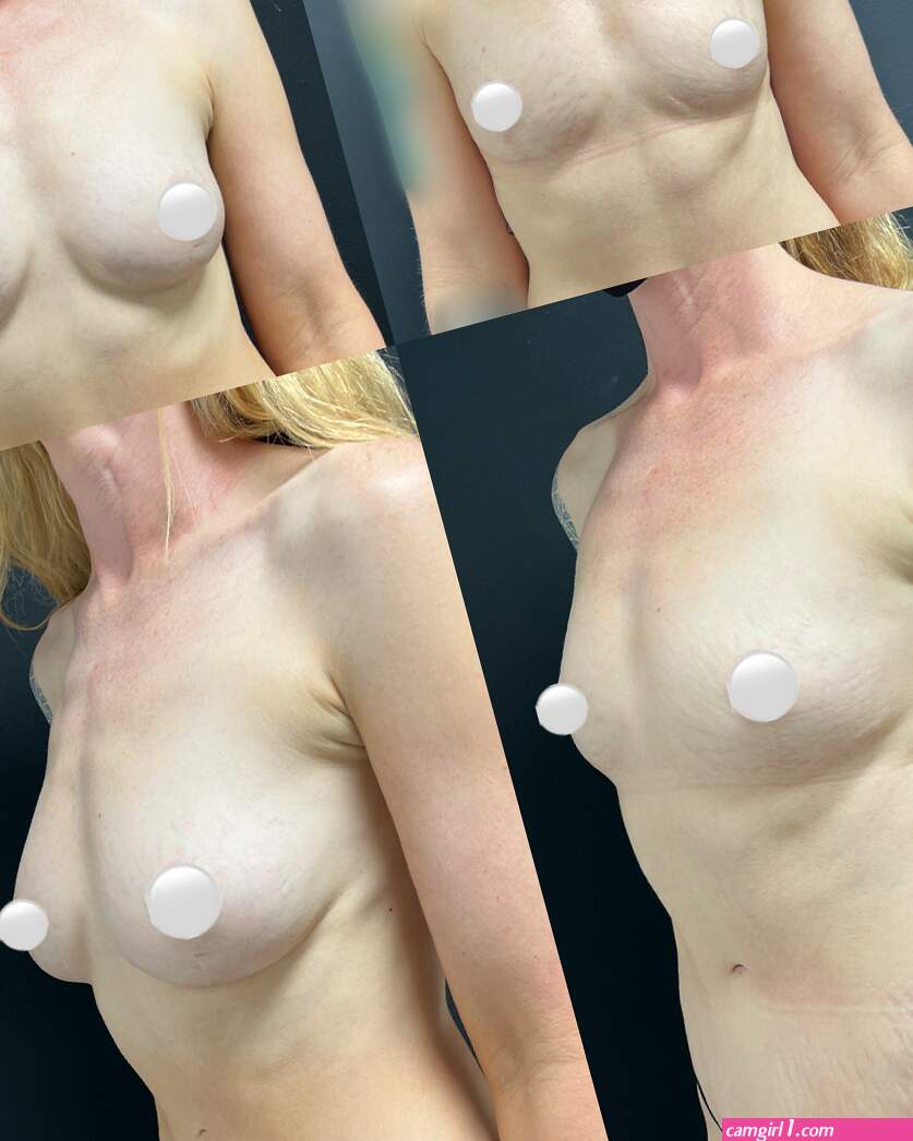 Natiral boobs (photos)